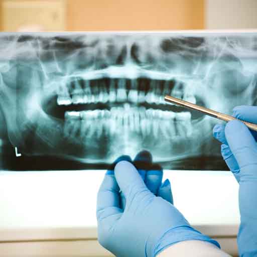Root Canals