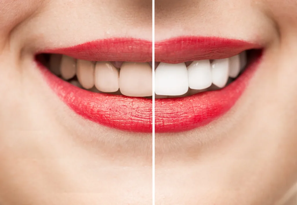 Cosmetic Dentistry